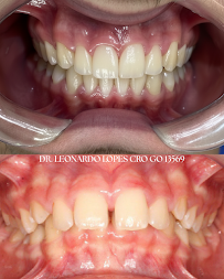 Rir Odontologia | Dentista em Goiânia
