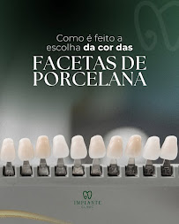 Implante Clinic - Botox - Implantes Dentários - Harmonização Facial - Goiânia