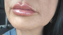 Implante Clinic - Botox - Implantes Dentários - Harmonização Facial - Goiânia