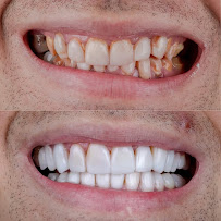 Implante Clinic - Botox - Implantes Dentários - Harmonização Facial - Goiânia