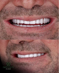 Implante Clinic - Botox - Implantes Dentários - Harmonização Facial - Goiânia
