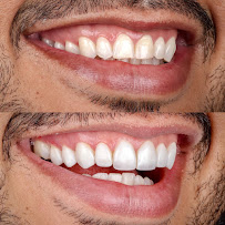 Implante Clinic - Botox - Implantes Dentários - Harmonização Facial - Goiânia