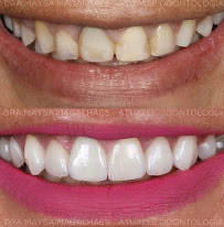 Atualle Odontologia
