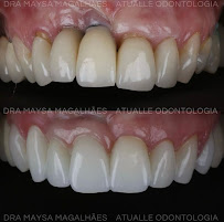 Atualle Odontologia