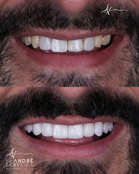 Dr. André Ferreira | Dentista Goiânia | CRO GO 5544