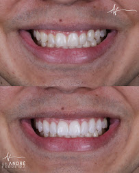 Dr. André Ferreira | Dentista Goiânia | CRO GO 5544