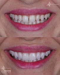 Dr. André Ferreira | Dentista Goiânia | CRO GO 5544