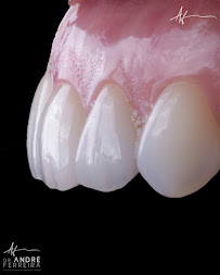 Dr. André Ferreira | Dentista Goiânia | CRO GO 5544