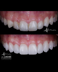Dr. André Ferreira | Dentista Goiânia | CRO GO 5544