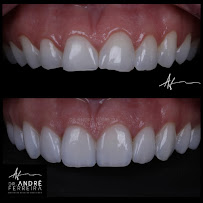 Dr. André Ferreira | Dentista Goiânia | CRO GO 5544