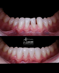 Dr. André Ferreira | Dentista Goiânia | CRO GO 5544