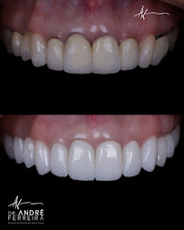 Dr. André Ferreira | Dentista Goiânia | CRO GO 5544