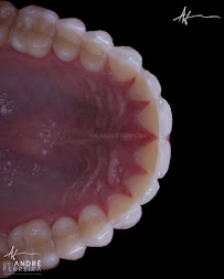 Dr. André Ferreira | Dentista Goiânia | CRO GO 5544