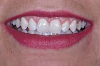 Dr. Mijail Preciado | Dentista en Guadalajara Odontología General & Cosmética Dental