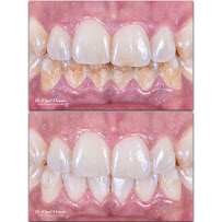 Dr. Mijail Preciado | Dentista en Guadalajara Odontología General & Cosmética Dental