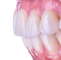 Dr. Mijail Preciado | Dentista en Guadalajara Odontología General & Cosmética Dental