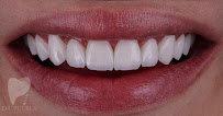 Consultorio Dental Dr. Puebla Dental Clinic in Guadalajara