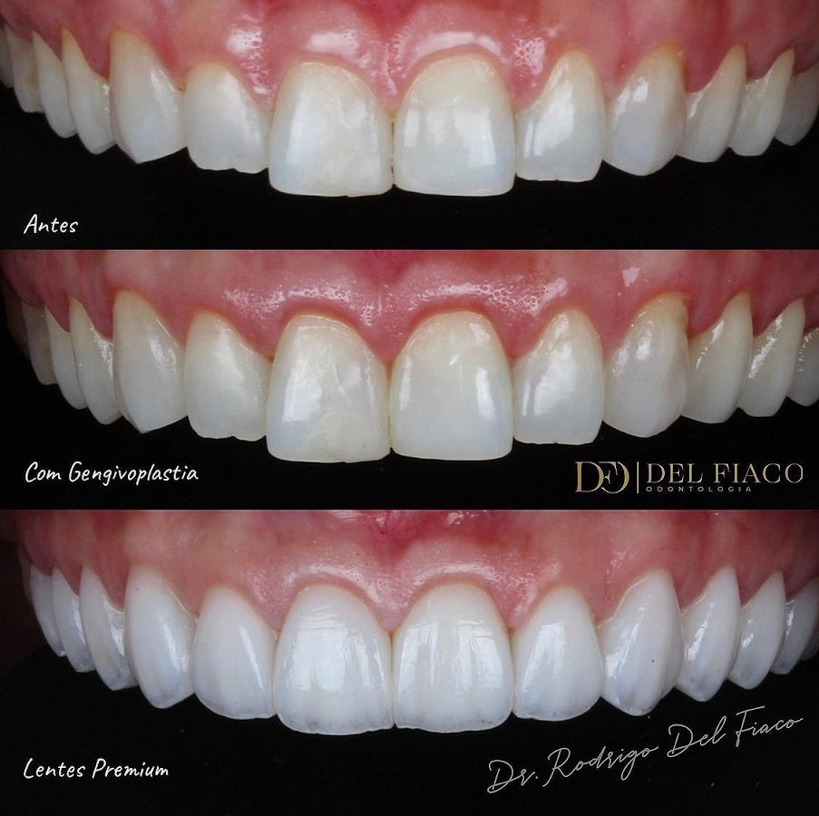 Dental Clinic Del Fiaco Odontologia dental clinic in Goiânia