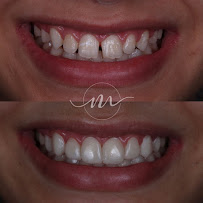 Instituto Matka Dentista Goiânia