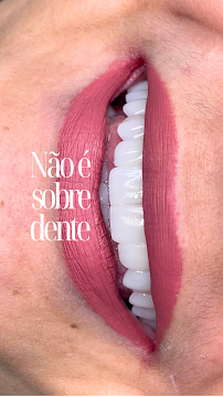 Avanço Implantes & Estética Dental