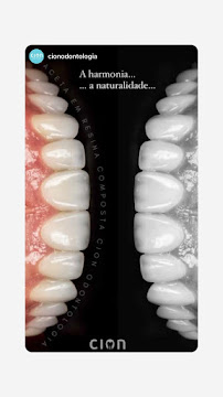 Cion Odontologia