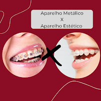 Sorriso Metálico Clinica Odontológica - Aparecida de Goiânia