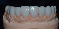 Clínica EquipeDente | Invisalign | Implante Dentário | Nazaré | Belém - PA