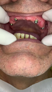 Clínica EquipeDente | Invisalign | Implante Dentário | Nazaré | Belém - PA