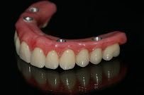 Clínica EquipeDente | Invisalign | Implante Dentário | Nazaré | Belém - PA
