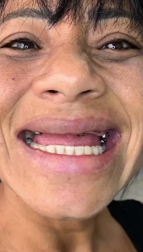 Clínica EquipeDente | Invisalign | Implante Dentário | Nazaré | Belém - PA