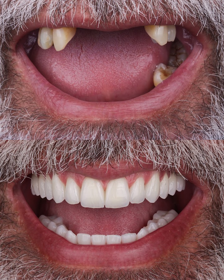 Oralfy Belém | Implante | Invisalign | Dentista em Belém - dental clinic in Belém, Brazil