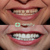 Oralfy Belém | Implante | Invisalign | Dentista em Belém