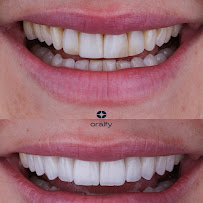 Oralfy Belém | Implante | Invisalign | Dentista em Belém