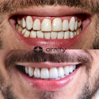 Oralfy Belém | Implante | Invisalign | Dentista em Belém