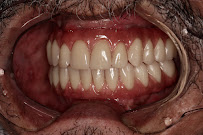 Oral Clínica
