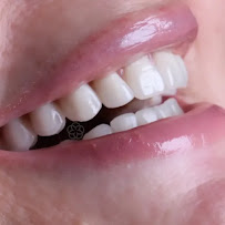 Sorridi Odontologia Especializada | Dentista | Implante Dentário | Nazaré | Belém - PA