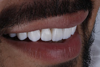 Clínica Dental en Chapalita - DEO Clinic - Dentista