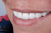 Clínica Dental en Chapalita - DEO Clinic - Dentista