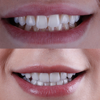 Clínica Dental en Chapalita - DEO Clinic - Dentista