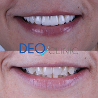 Clínica Dental en Chapalita - DEO Clinic - Dentista