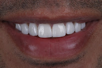 Clínica Dental en Chapalita - DEO Clinic - Dentista