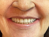 Clínica Otorisus | Implante Dental | Invisalign | Lente de Contato Dental | Harmonização | Implante coclear | Bera c/ Sedação