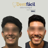 Dentfácil