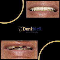 Dentfácil