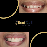 Dentfácil