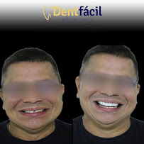 Dentfácil