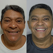 Dentfácil