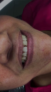 Dentfácil