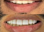 Clínica Odontológica Smile - Anderson Braga