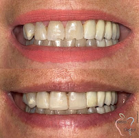 Nueva Sonrisa Dental